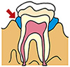 歯ぐきの状態